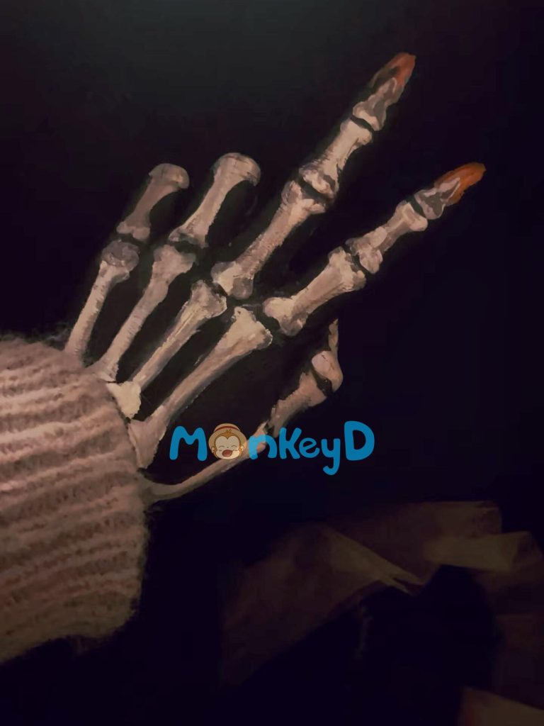 Ngón tay đứt trong chậu hoa